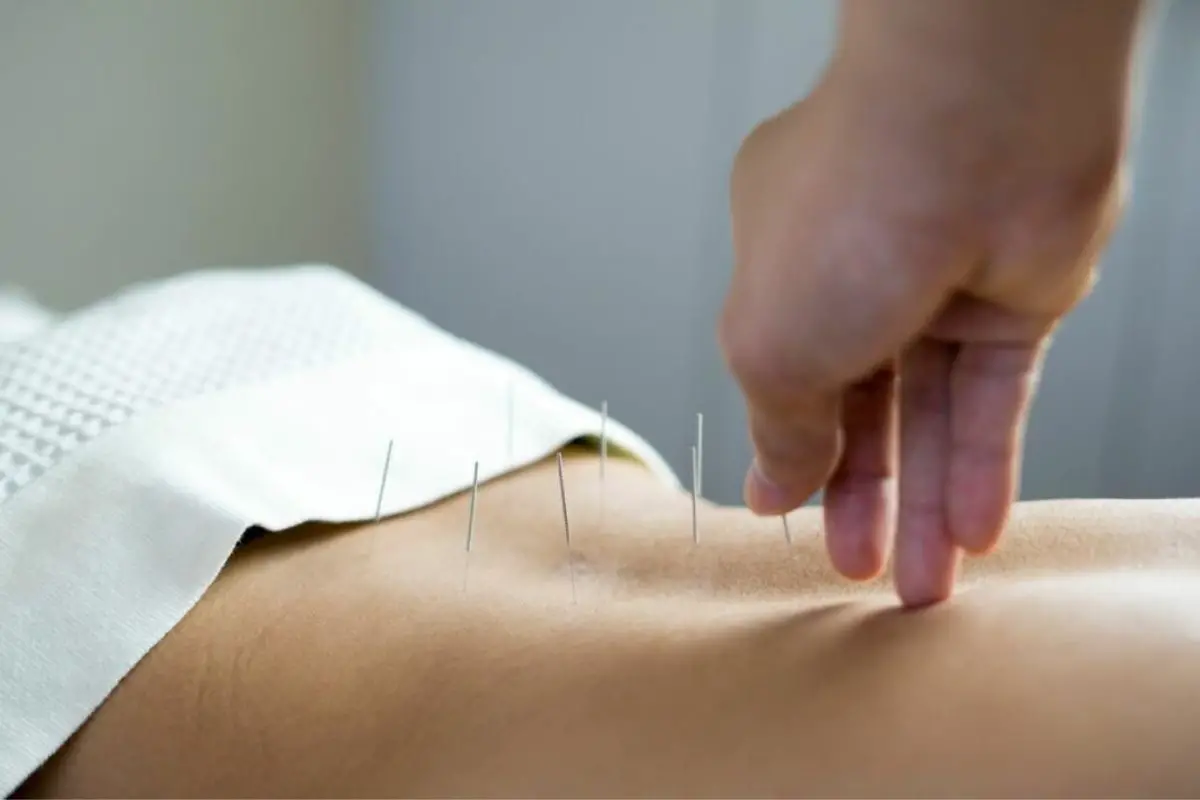 4. Acupuncture Clinic Of Fort Collins