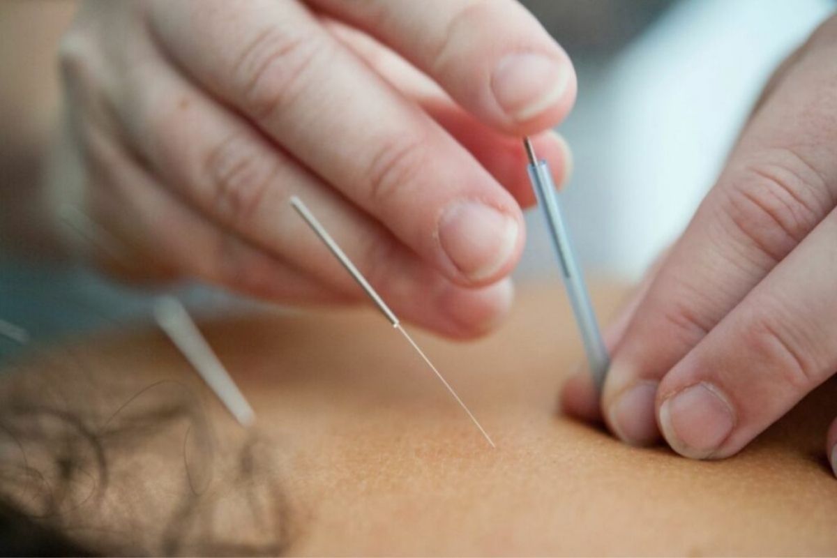Dr. Lee’s Newport Acupuncture