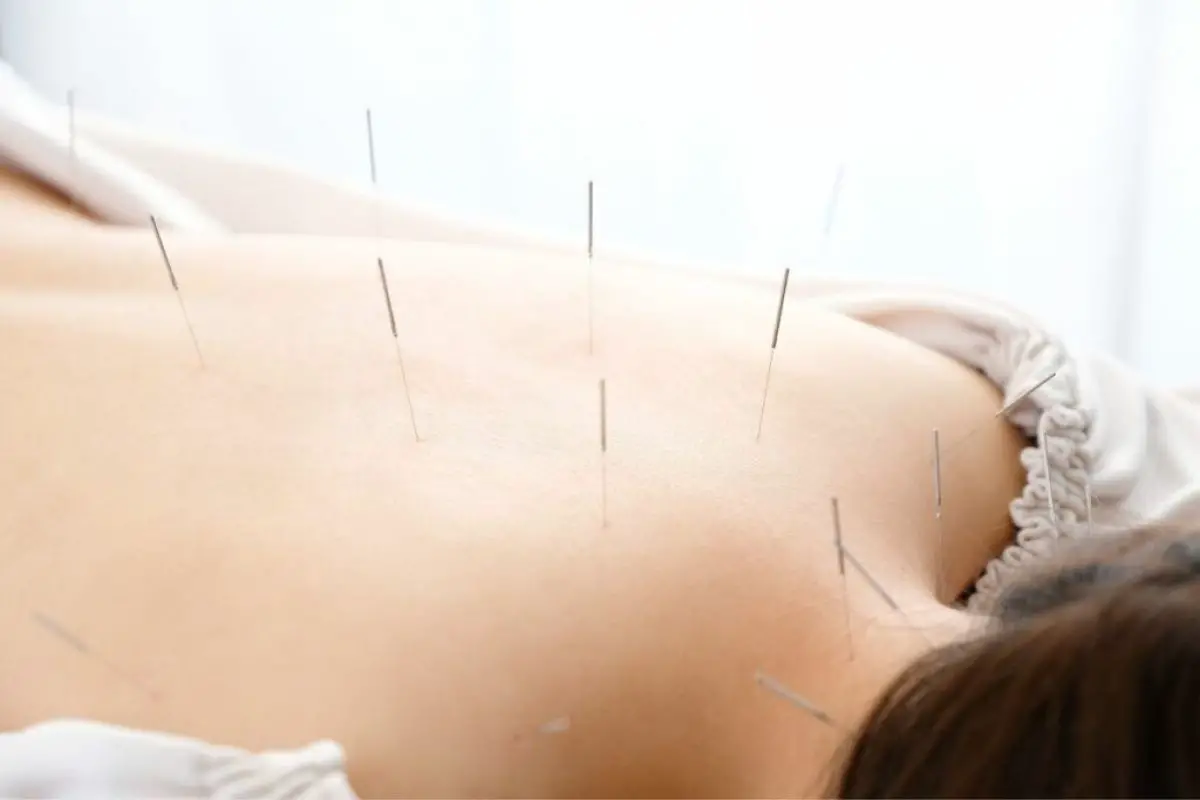 Gianina Knoth Acupuncture