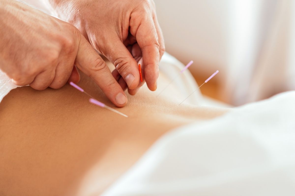 TCR Acupuncture