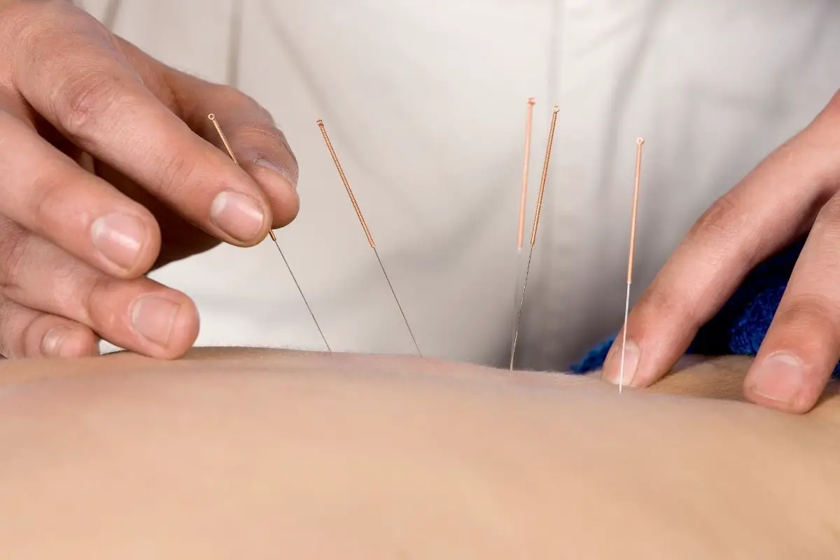 Holistic Vitality Acupuncture