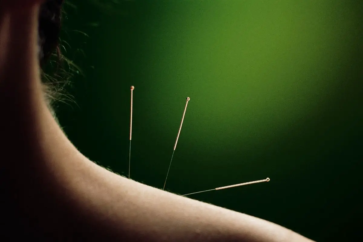 JLV Acupuncture