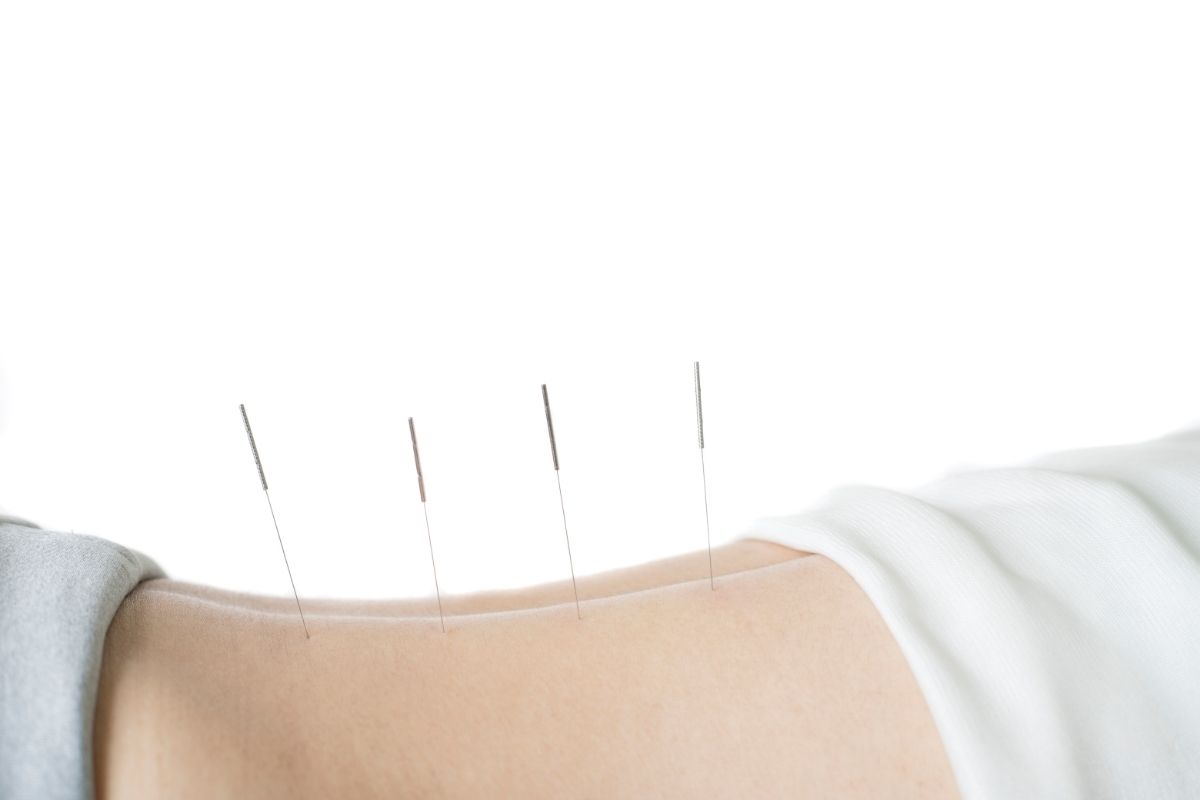 Marion Ringenbach Acupuncture
