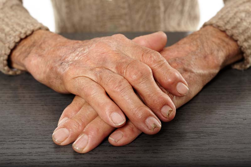 How To Use Reflexology For Arthritis Like A Pro