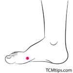 5 Acupressure Points For Peripheral Neuropathy - TCM Tips