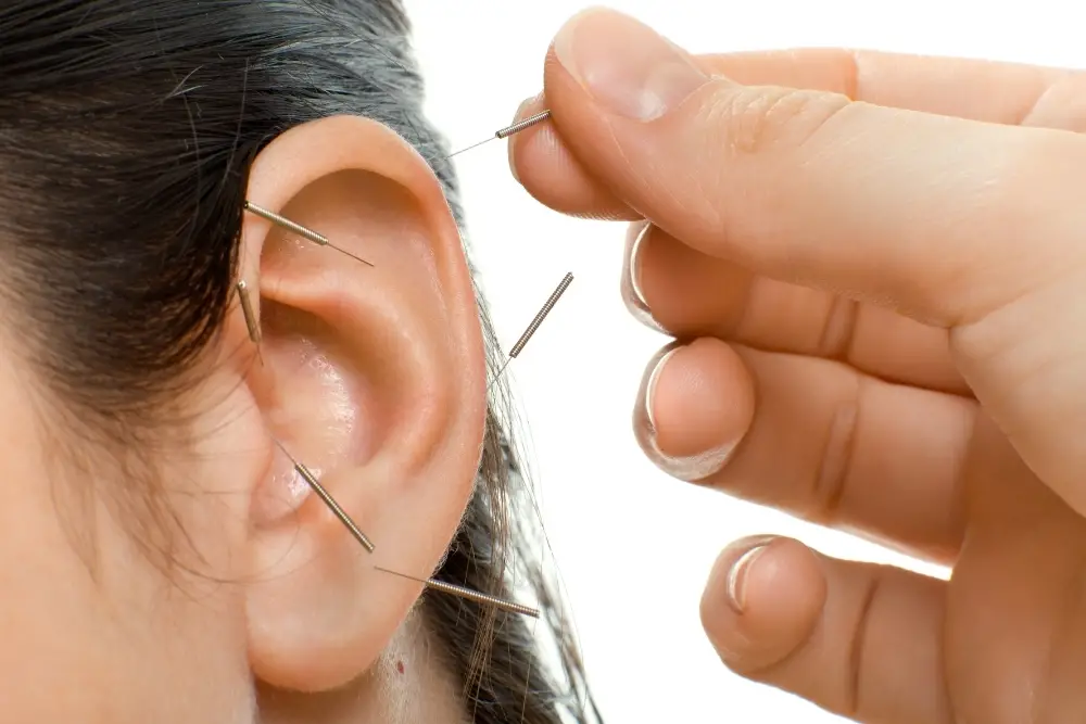 Ear Seeds Acupuncture Near Me Reviews