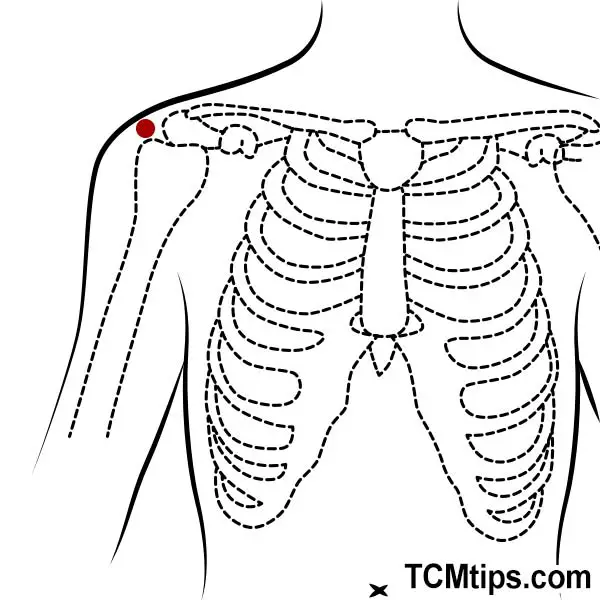 Acupuncture For Bicep Tendonitis: Everything You Need To Know - TCM Tips