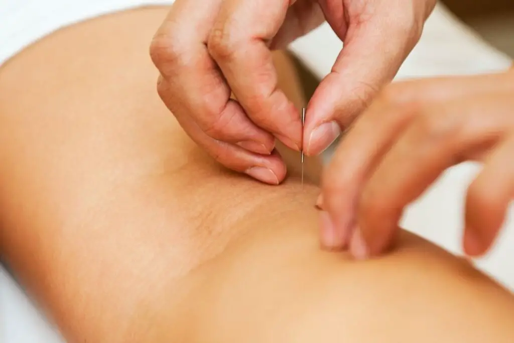 How To Use An Acupuncture Pen For Anxiety
