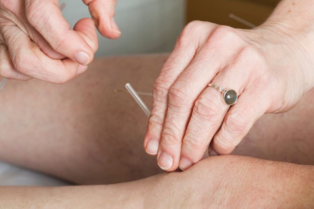 How To Use An Acupuncture Pen On Your Knee