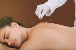5 Best Acupuncture Clinics In Houston