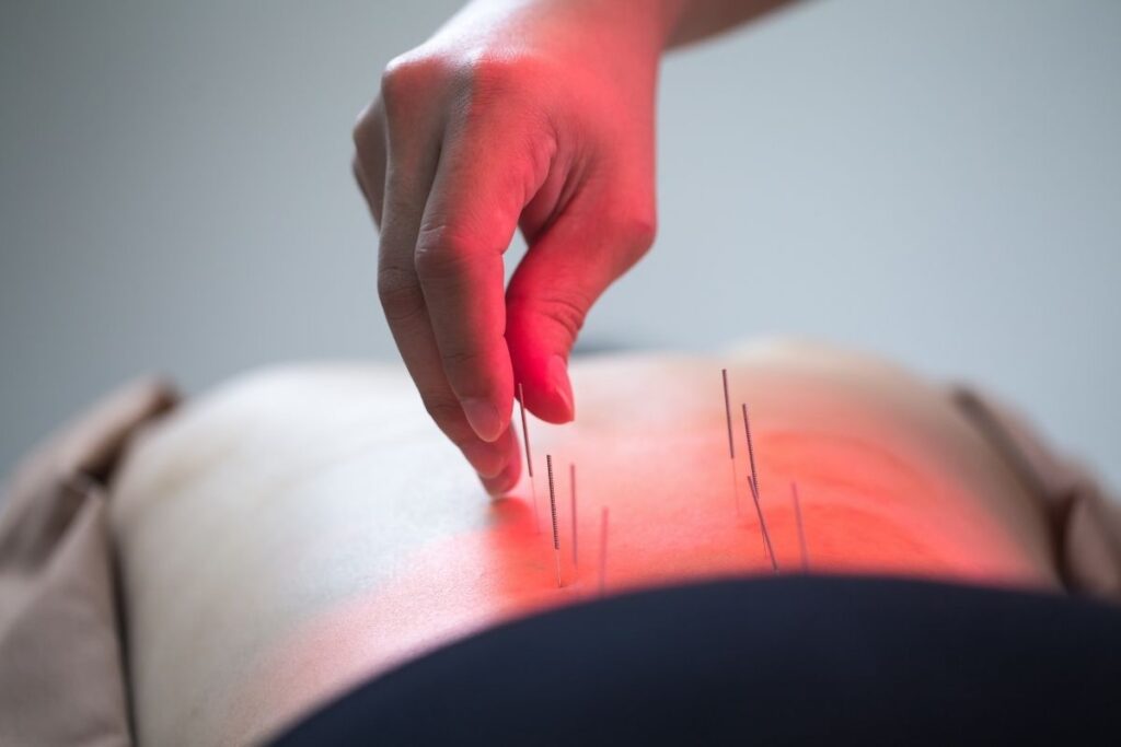 5 Best Places For Acupuncture In Eugene TCM Tips