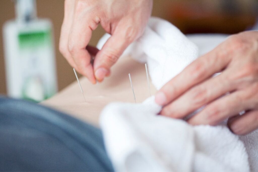 Best Places For Acupuncture In Corpus Christi