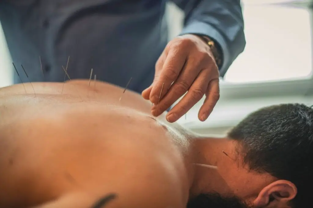 The Best 3 Acupuncture Clinics In Anderson, South Carolina