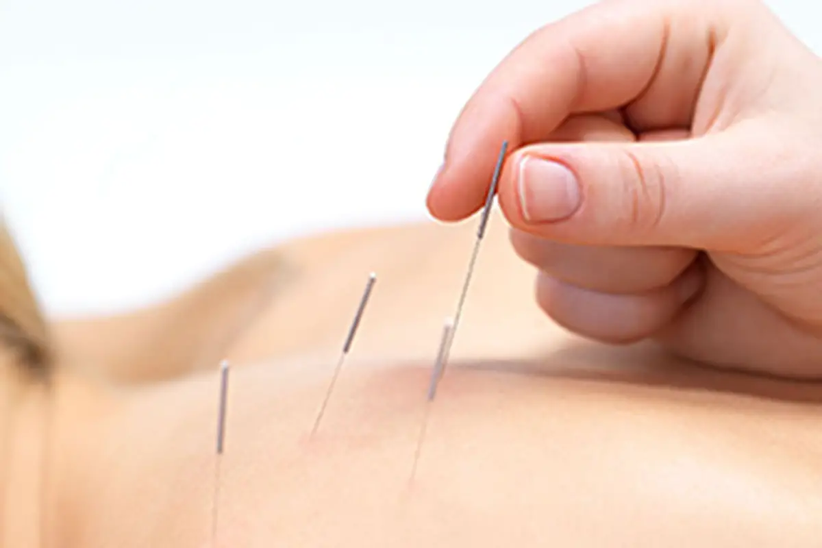 Tree Of Qi Acupuncture Clinic TCM Tips