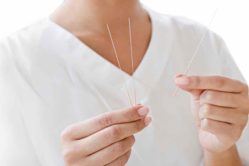 The 4 Best Acupuncture Clinics In Simi Valley TCM Tips