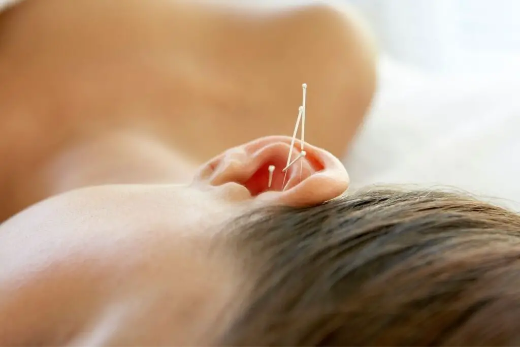 4 Best Acupuncture Places In Greenville (North Carolina) TCM Tips