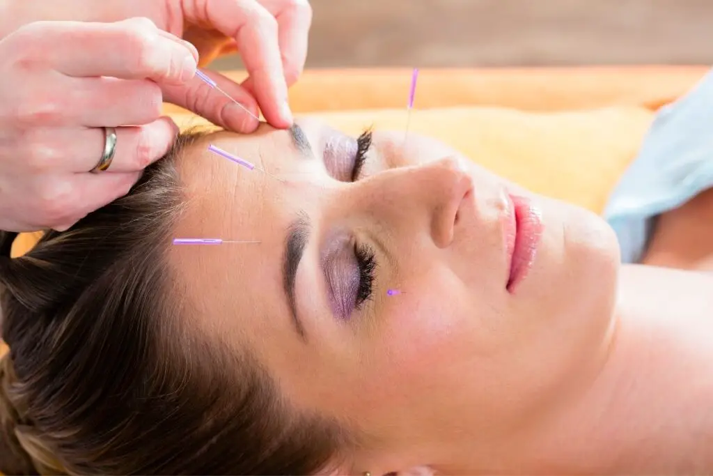 Best Acupuncture Places In Georgetown, Texas - TCM Tips